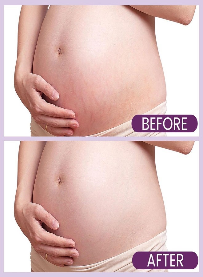 AOAO Stretch Mark Butter for Pregnancy | Body Balm for Women with Shea Butter & Vitamin E | Paraben-Free Formula for Scars & Stretch Mark Repair | Belly Butter for Pregnant Women (Shea Butter_1) - Image 4